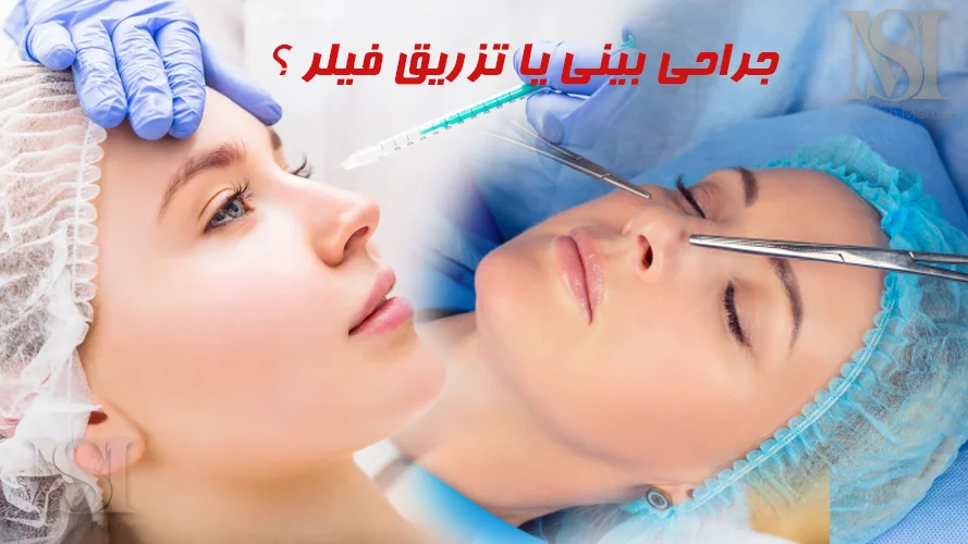 فیلر بینی یا جراحی رینوپلاستی؟