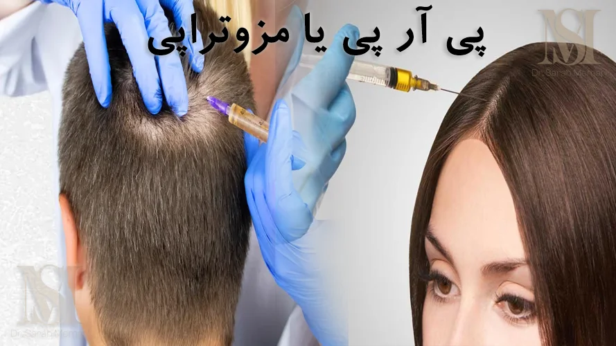 PRPیا مزوتراپی