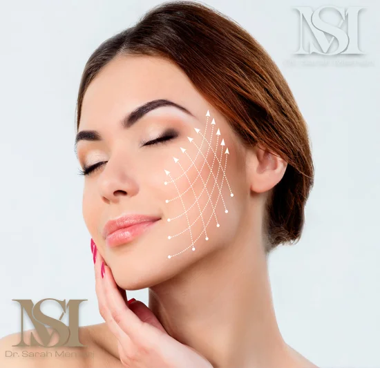 لیفت صورت با نخ