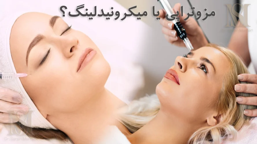 مزوتراپی یا میکرونیدلینگ