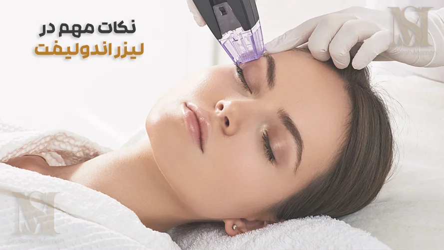 لیزر اندولیفت