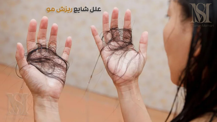 دلایل ریزش مو در خانم ها