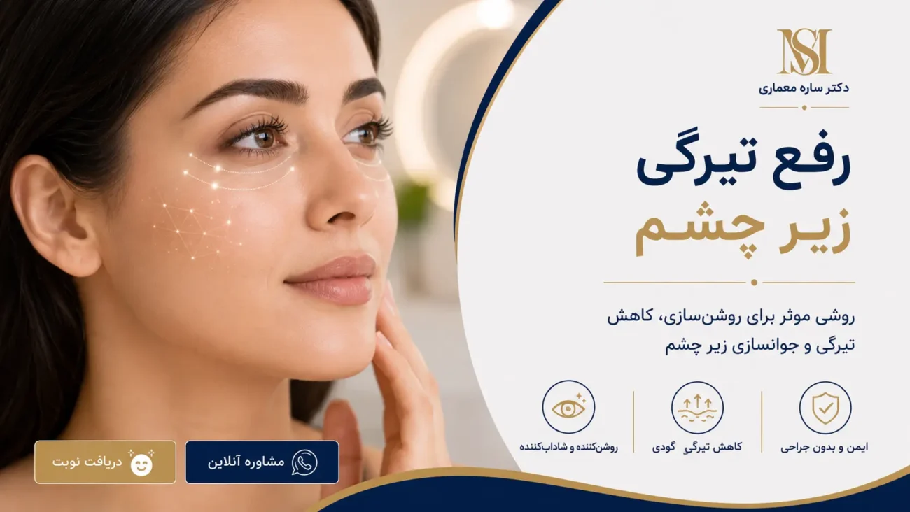 رفع تیرگی دور چشم