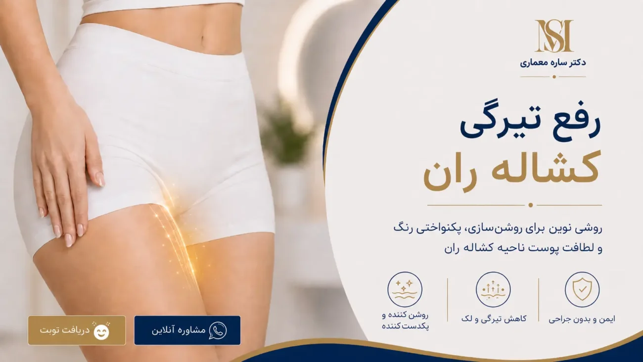 رفع تیرگی کشاله ران
